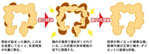 老廃物を排出して痩せやすい体質に